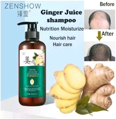 Syampu Halia Anti Rambut Gugur